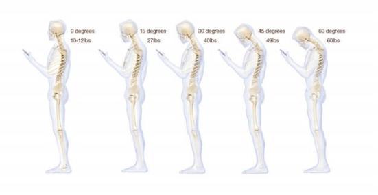 长时间低头玩手机会导致脊柱弯曲